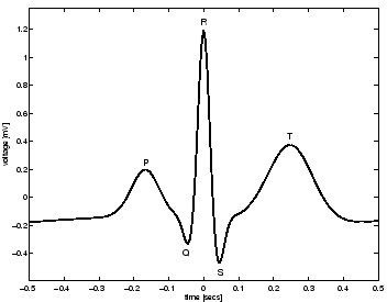 \begin{figure}
\centerline{\psfig{file=pqrstcomplex.eps,width=7.75cm}}
\end{figure}