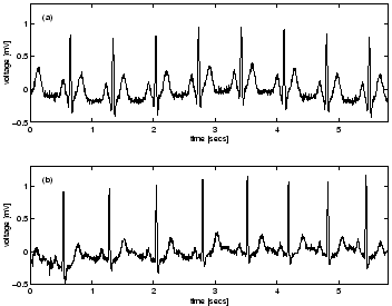 \begin{figure}
\centerline{\psfig{file=ecgcomparison.eps,width=7.75cm}}
\end{figure}