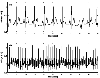 \begin{figure}
\centerline{\psfig{file=ecgsynthetic.eps,width=7.75cm}}
\end{figure}