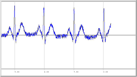 ECGSYN-Java Output Sample image